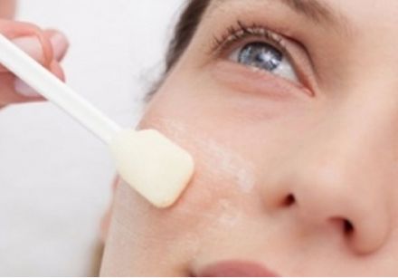 Peeling à l'acide glycolique - AHA