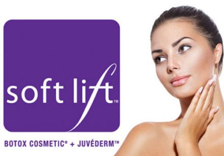 What is a Soft Lift?