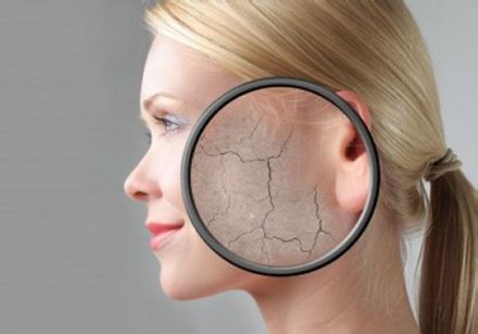 Avez-vous une peau sèche?