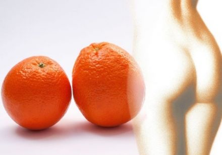 Les causes de la cellulite