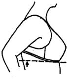 Bra - Is the back of your bra riding higher than the front?