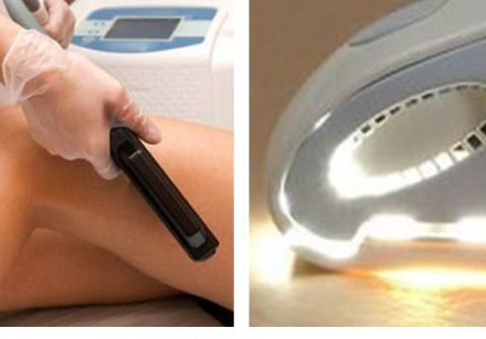 Quiz: What is the difference between laser hair removal and intense pulsed light hair removal?