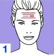 Expression Lines and fibroplastic contractions  1