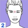 Expression Lines and fibroplastic contractions 2