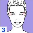 Expression Lines and fibroplastic contractions 3