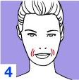 Expression Lines and fibroplastic contractions 4