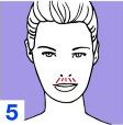 Expression Lines and fibroplastic contractions 5