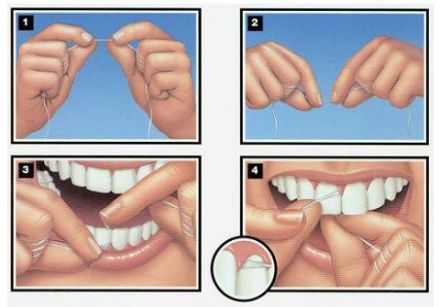 Teeth file > Four Key Elements Of Proper Flossing 1